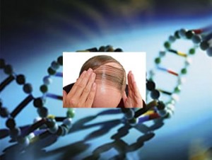 calvizie-ereditaria-perdita-capelli-di-origine-genetica
