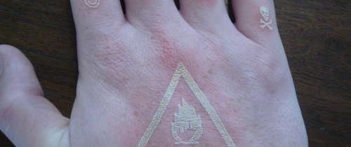 Il tatuaggio “laser”